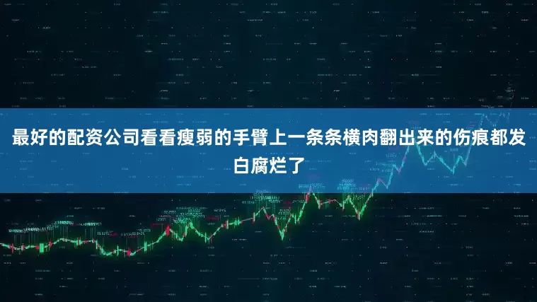 最好的配资公司看看瘦弱的手臂上一条条横肉翻出来的伤痕都发白腐烂了